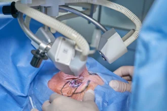 The Benefits of Choosing Laser Eye Surgery Over Glasses or Contacts