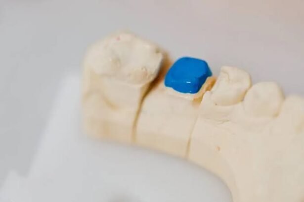 Teeth Gap Filling: Everything You Need to Know