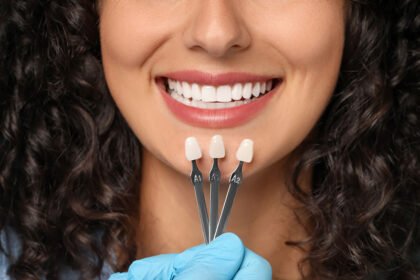 How to Prepare for Your Veneer Consultation
